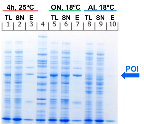Small scale expression and purification tests – Protein Expression and  Purification Core Facility