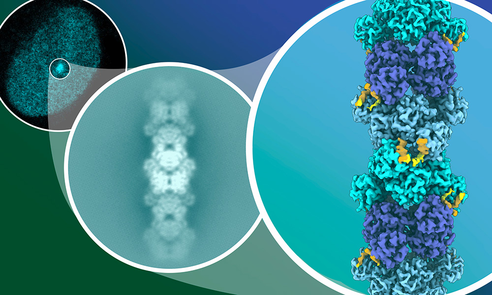 Illustration consisting of three panels. Upper left, a cyan granular oval shape (cell nucleus) with a brighter cyan spot in it. The middle panel: broad and narrow elements arranged alternatingly into a bright chain. On the right: molecular model, which shows the same chain of molecules as in the middle panel, but in more detail and in multiple colours.