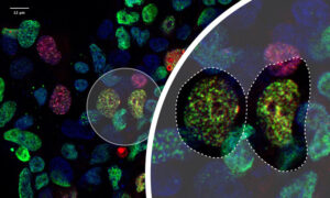 Microscopy image of cells stained in different colours. Two of them are surrounded with a white circle, which is zoomed in on the right side of the image. In the zoomed-in area, two cells are surrounded by dotted lines matching the shape of the cells. All other cells in the zoomed-in area are faded.