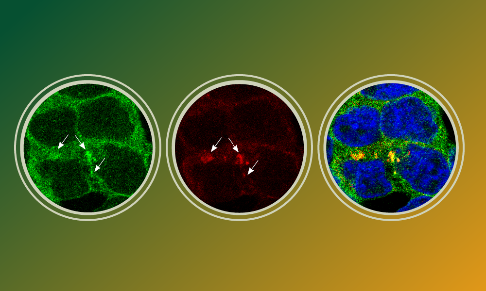 Three inset circles on a gradient background showing microscopy images of four cells in a grid. The left circle shows TRIM25 protein concentrated around the borders of cells, the middle circle shows a few dots representing a virus, and the third circle shows the first two superimposed.