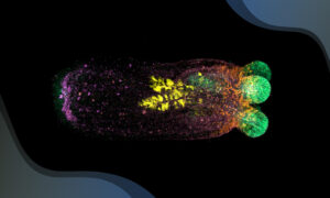 The sea anemone is visible as an elongated shape against a dark background, with gene expression visible in four colours (green – concentrated in the tentacles to the right, orange – at the base of the tentacles, yellow – in a leaf shape near the middle, purple – concentrated in the end opposite the tentacles, to the left)