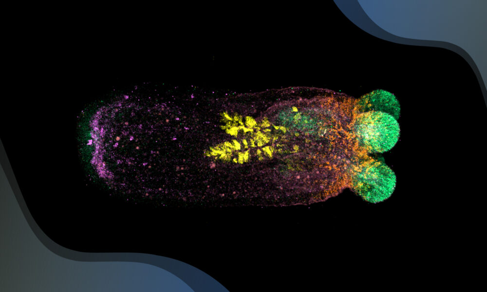 The sea anemone is visible as an elongated shape against a dark background, with gene expression visible in four colours (green - concentrated in the tentacles to the right, orange - at the base of the tentacles, yellow - in a leaf shape near the middle, purple - concentrated in the end opposite the tentacles, to the left)