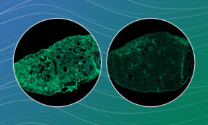 The image shows two circles. On the left circle it is shown a microscopy image of a mice lung full of scarring tissue. On the right circle it is shown a microscopy image of a mice lung with less scars.